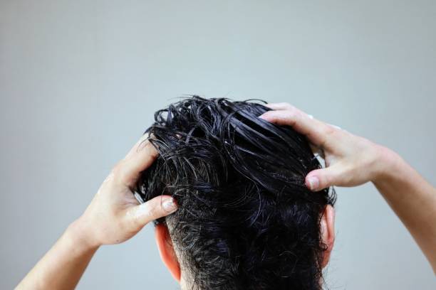 Scalp Treatments